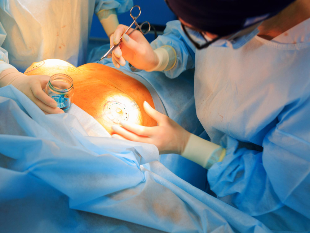 Breast Surgery